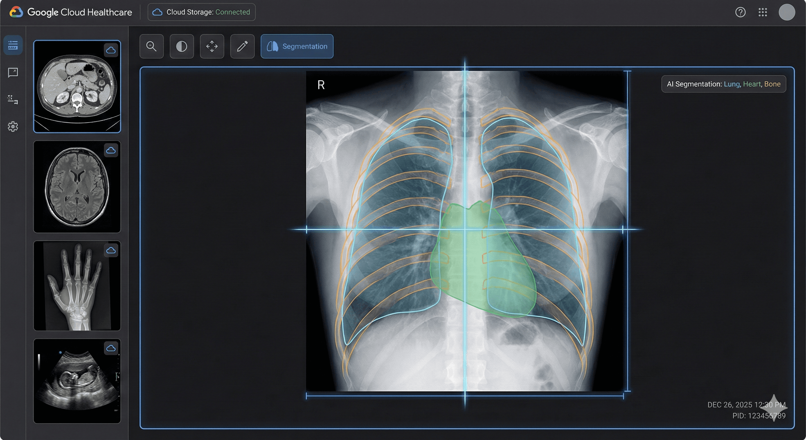 DICOM upload & viewing in SmartCarePlus